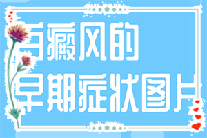 嬰兒手上有白斑是缺乏維生素嗎,常見原因(病情加重是因為什么)