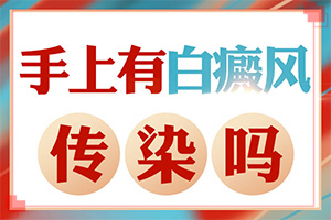 白點癲風有什么癥狀,癥狀歸納總結(如何判斷是不是)