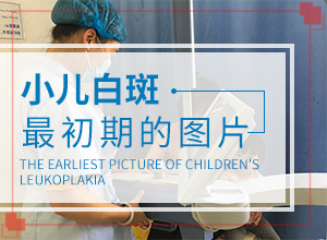 孩子背后長白斑怎么辦,不同時期的病發(fā)表現(xiàn)是怎樣的(要做什么檢查)