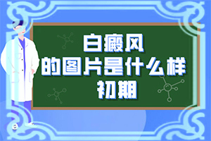 手背上有白斑是什么原因引起的,哪些緣由導致(有什么因素呢)
