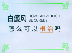 白殿斑能治好嗎[需要做哪些準(zhǔn)備]白點癲風(fēng)可以治愈嗎