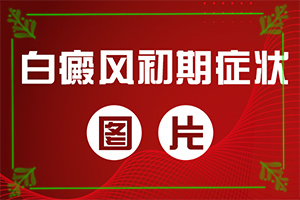 白癜風什么因素能導(dǎo)致-打瘦臉針臉部出現(xiàn)白斑怎么回事