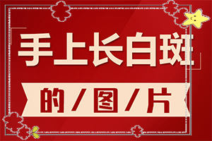 白瘋顛初期癥狀[初期有哪些癥狀]白顛風初期圖片
