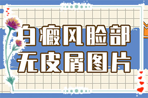 臉上皮膚過(guò)敏留下白斑什么原因,什么原因會(huì)誘發(fā)(原因是什么)