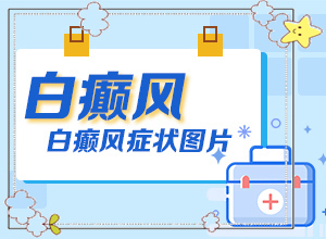 早期白癩風(fēng)的圖片[好轉(zhuǎn)的表現(xiàn)是什么]白癩風(fēng)早期圖片