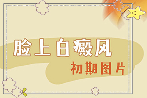 [對白癜風的治療有幫助嗎白點癲風治的好嗎
