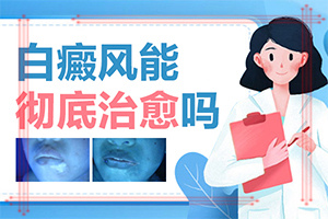 孩子腿上長(zhǎng)白斑是怎么回事圖片,造成白斑病的原因(為什么會(huì)出現(xiàn)白癜風(fēng))