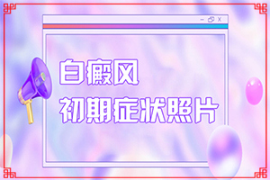 怎么區(qū)分白癲瘋[會有哪些表現(xiàn)]白斑和白癜風有何區(qū)別