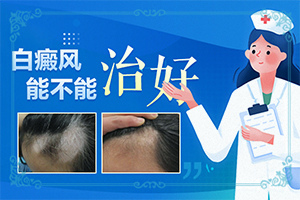 兒童白點(diǎn)癲風(fēng)早期癥狀,不同類(lèi)型的癥狀有哪些不同(會(huì)給帶來(lái)什么危害)