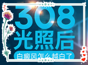 白班用什么藥可以治療[白斑治療常識有哪些]白瘕風能治療嗎