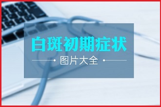 白點風(fēng)患者如何進(jìn)行科學(xué)有效的醫(yī)治