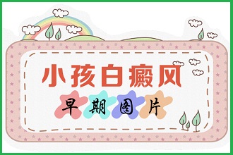 白癩風(fēng)病情對(duì)患者會(huì)造成哪些影響呢