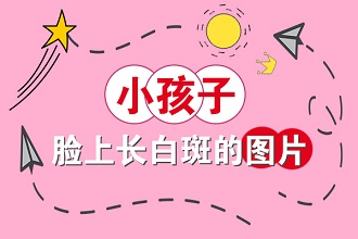 白癩風患者可以使用遮蓋液嗎?遠離不利因素才是重點