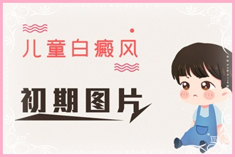 青少年白癩風頻發(fā)，這些原因你都了解嗎