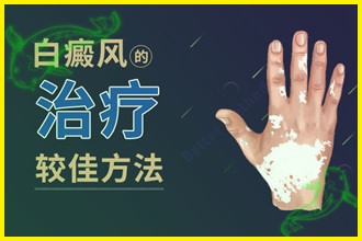 白顛風(fēng)怎么治療好的快-檢查病因、制定方法、防護三步走