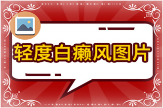 輕微的白癩風圖片這些行為不能有，不然自身病情會加重