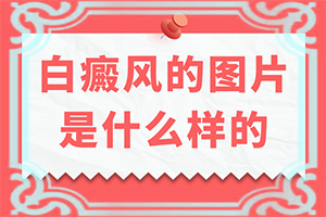 只有手上長(zhǎng)白怎么治[治療需要注意什么]新治療白癲的方法
