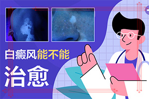 白斑是怎么形成的原因-兒童身上出現(xiàn)白斑的原因有哪些