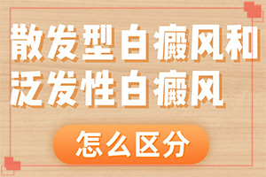 白顛風能治好嗎[需要做哪些準備]手上一年多白斑怎么治呢