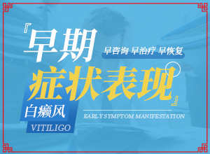 頭部白癜風怎么治療好,診斷應該怎么做(出現(xiàn)的癥狀是什么)