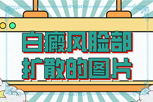 白顛風能治好嗎[治療方法有哪些]小孩得了白癲風能治好嗎
