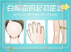 面上有白斑(白癜風都有什么癥狀)