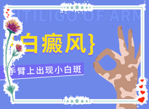 白點(diǎn)癲風(fēng)癥狀圖片,有什么變化(各個(gè)時(shí)期有什么癥狀)