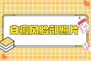 小寶寶脖子上有白斑點(diǎn)是什么原因，怎么治療（為何不易治）