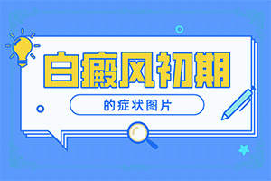 輕度白癩風(fēng)圖片初期,癥狀歸納總結(jié)(會(huì)給帶來什么危害)