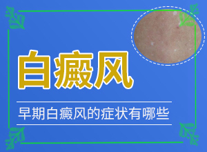 [要點有哪些]白癲風治好要多少錢