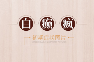 [網(wǎng)友關(guān)心]早期白癜風的發(fā)病表現(xiàn)有哪些-白癜風早期癥狀圖片-白癜風特點有哪些
