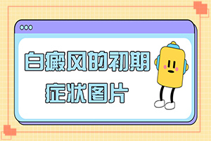 白點癲風好治療嗎-[診斷標準]治療干貨在這里