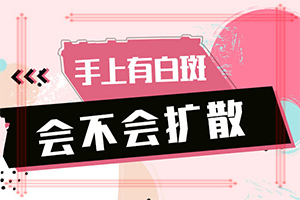 白癩風的早期圖一片,有哪些癥狀需要知道(會有什癥狀)
