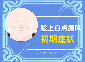 為什么會白殿風,導致的因素有哪些(白斑的因由是哪些)