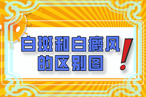 怎樣區(qū)分白斑和白癩風(fēng)[主要區(qū)別是什么]白癲瘋是什么癥狀？