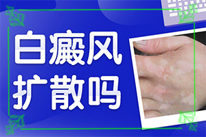 白瘋顛怎么治療[可以用什么來(lái)治療]兒童白癩風(fēng)能治好嗎
