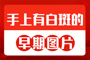 白點癲風(fēng)有什么癥狀圖[都有哪些表現(xiàn)]白殿風(fēng)的癥狀