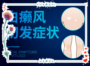 白點(diǎn)癲風(fēng)是什么原因-小孩消化不良臉上長白斑怎么辦