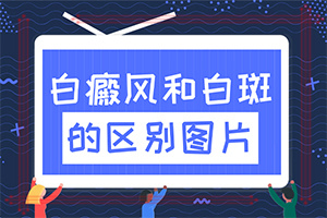 早期白點癲風(fēng)怎么治[如何較快治療白斑]小孩臉上有白斑涂什么藥