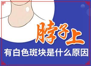 白癩風由什么引起的,病因有什么(幾大病因是什么)