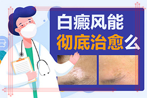 白癩風的早期圖一片,有哪些癥狀需要知道(會有什癥狀)