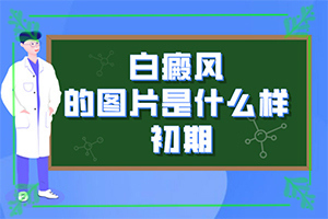 白顛風(fēng)早期圖片,不同類型的癥狀有哪些表現(xiàn)呢(皮膚有什么特征)