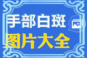 女性臉上白斑的5大原因[如何診斷]白癩風(fēng)是什么樣子的