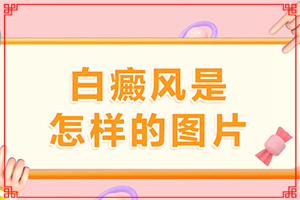 白點(diǎn)癲風(fēng)哪里治療好[科學(xué)正確治療方法]兒童白癲風(fēng)可以治愈嗎