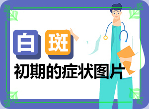 太陽(yáng)曬后出現(xiàn)白斑是什么原因-5歲寶寶臉上長(zhǎng)白斑是怎么回事