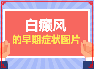白癩風(fēng)早期癥狀,有一小部分(得了會有什么癥狀呢)