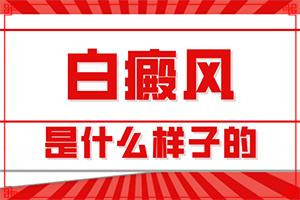 白點癲風(fēng)是什么原因造成的-四個月寶寶肚子長白斑怎么回事