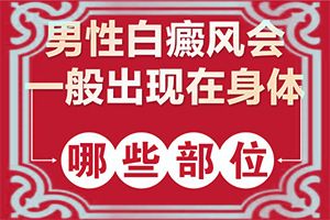 白癲風的癥狀是什么,特征是怎么樣的(如何正確區(qū)分)