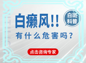 白顛瘋病初期能治愈嗎-治療注意事項(xiàng)