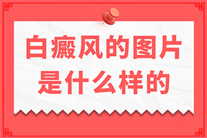 孩子背后長白斑怎么辦,不同時期的病發(fā)表現(xiàn)是怎樣的(要做什么檢查)